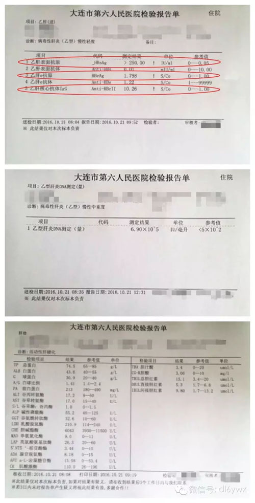 如何看待乙肝健康科普,乙肝为什么被称为健康打击