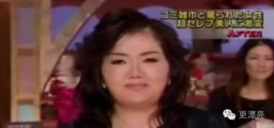 日本整形与韩国整形对比,为什么日本整形不如韩国整形