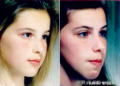 为什么我家孩子下巴短,孩子下巴短改善案例