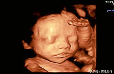 二胎四维照片官宣模板,二胎四维顺利通过吗