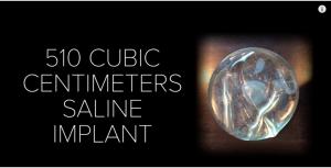 隆过的胸和正常的胸有什么区别,隆过的胸是不是很硬