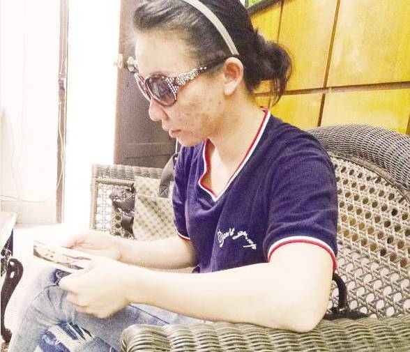 女性祛痘痘被毁容,打水光针毁容的视频