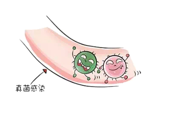儿童耵聍要不要掏,宝宝耵聍要不要掏出来
