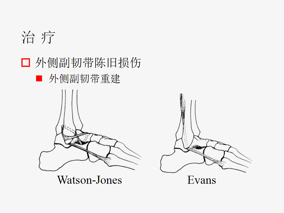 脚崴了怎么办判断是否骨折,脚崴了怎么办视频