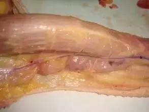 鸭脖子的淋巴能吃吗,鸭脖子上的淋巴吃了会怎么样