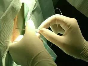 关于麻醉这些注意事项要知道,硬膜外麻醉的术后注意事项