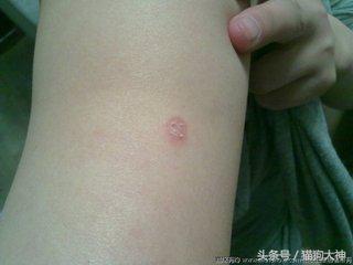 人得了猫癣如何预防猫癣扩散,被感染猫癣了怎么办