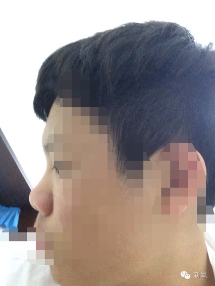 林允是不是整鼻子了,林允隆鼻过吗