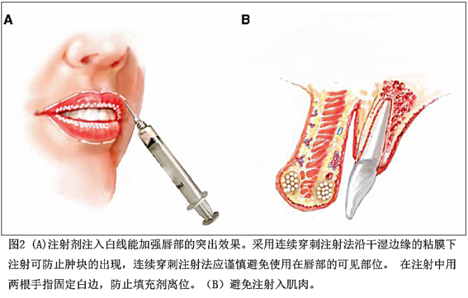 欧洲、亚洲、非洲丰唇标准及注射剂量