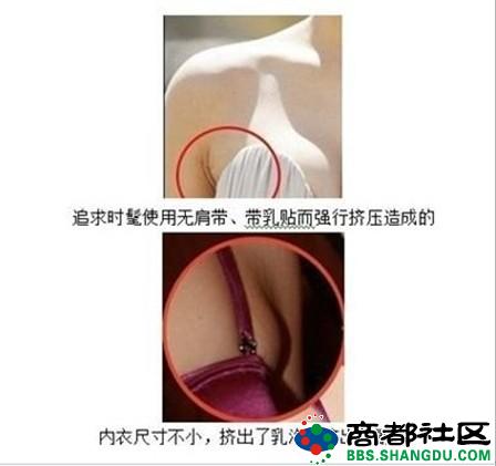 腋窝下有淋巴结会引起乳腺癌吗,腋下淋巴结会是乳腺癌吗