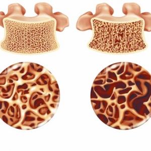 腰疼是有重大疾病吗,腰疼除了腰的问题还有别的原因