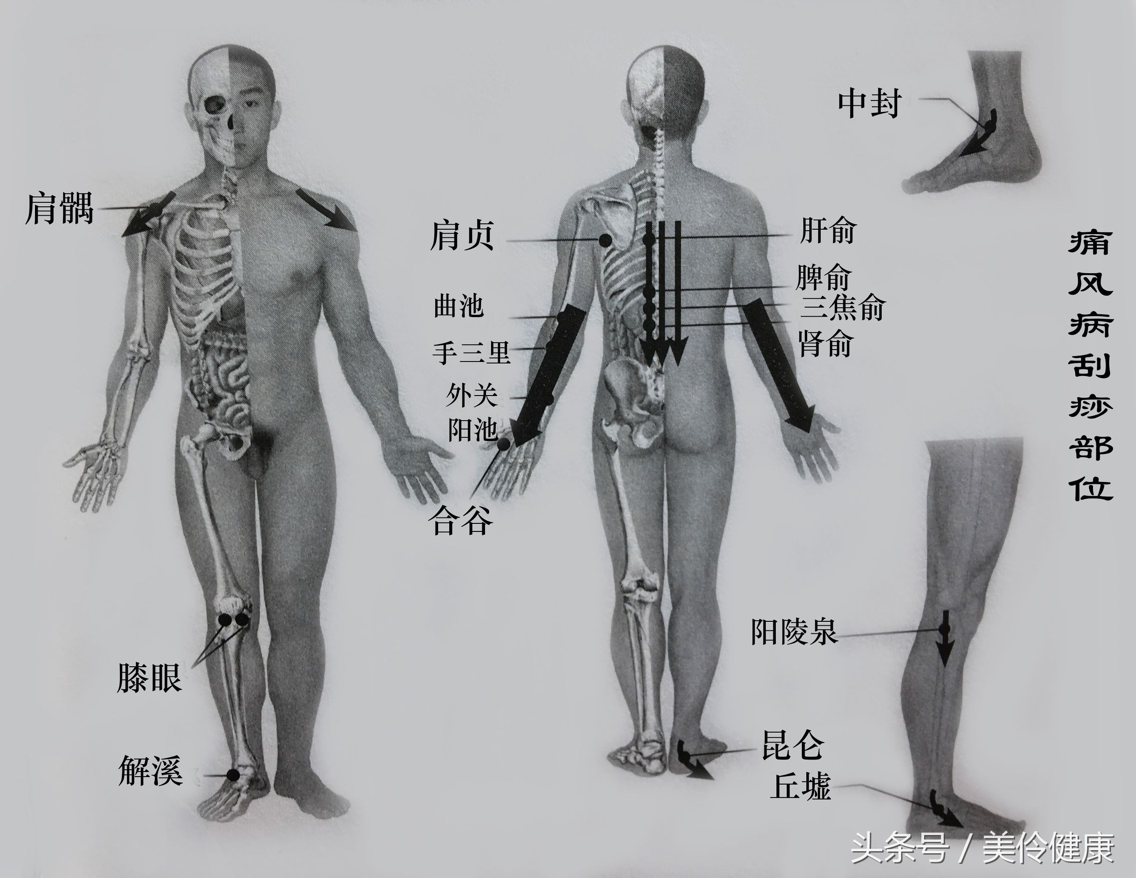 痛风脂肪肝怎么减肥,刮痧治疗儿童肥胖症科普视频