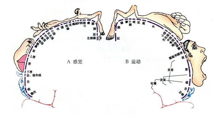 大脑前动脉梗死属于小动脉梗死吗,左侧大脑中动脉闭塞大面积梗死
