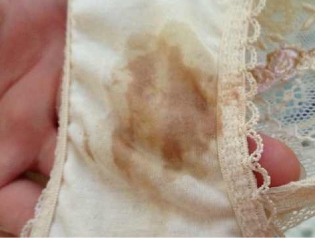 孕晚期出现意外就医去哪里,孕晚期出血可能是哪些情况导致