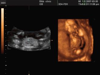 镇原协和医院四维彩超怎么样,庆阳市第一人民医院四维彩超