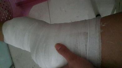 半月板平时注意事项怎样恢复更快,半月板检查需要注意什么