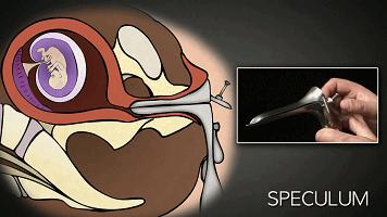 到底是人流还是药流怎么选太纠结,哺乳期选择药流还是人流