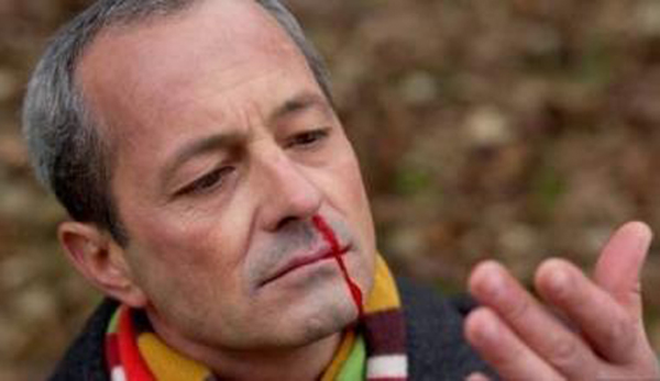 血热头发白怎么可以治,血热手指爆皮怎么办