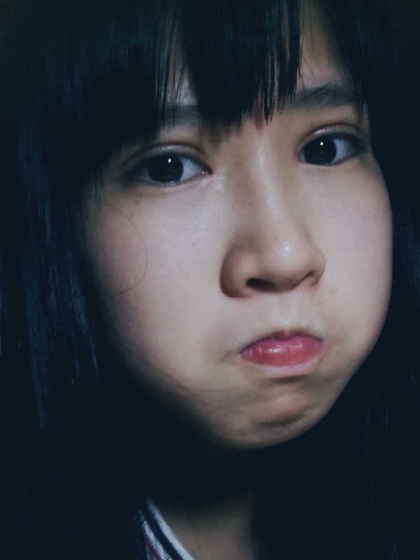 抽脂双眼皮做完眼睛有褶,割双眼皮肿成一条缝