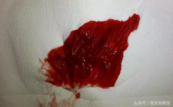 预产期到了宝宝多久能出来,准妈妈需要知道的分娩3个征兆