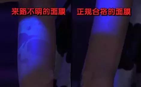 脸上长黄斑怎么检查,看脸上的斑如何知道什么病因