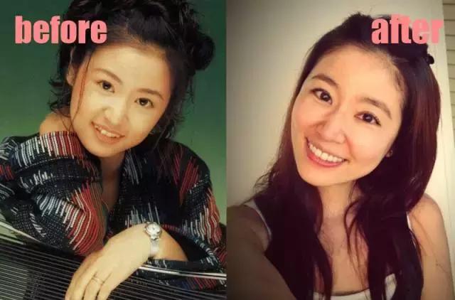 整牙=整容?看杨幂、刘涛、高圆圆为你亲身示范!