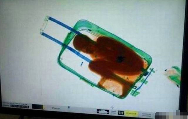 女装癖是心理疾病吗,女装癖什么意思