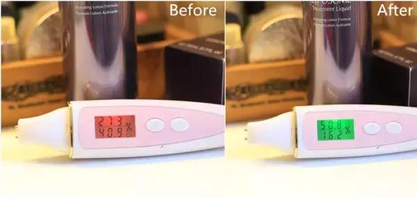 日本高机能化妆水排行,这6款化妆水最适合干皮