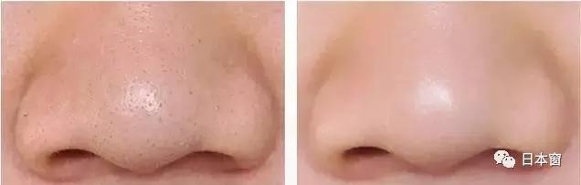 美容院用的胎盘素紧致精华液,美容院专用面部补水保湿按摩膏