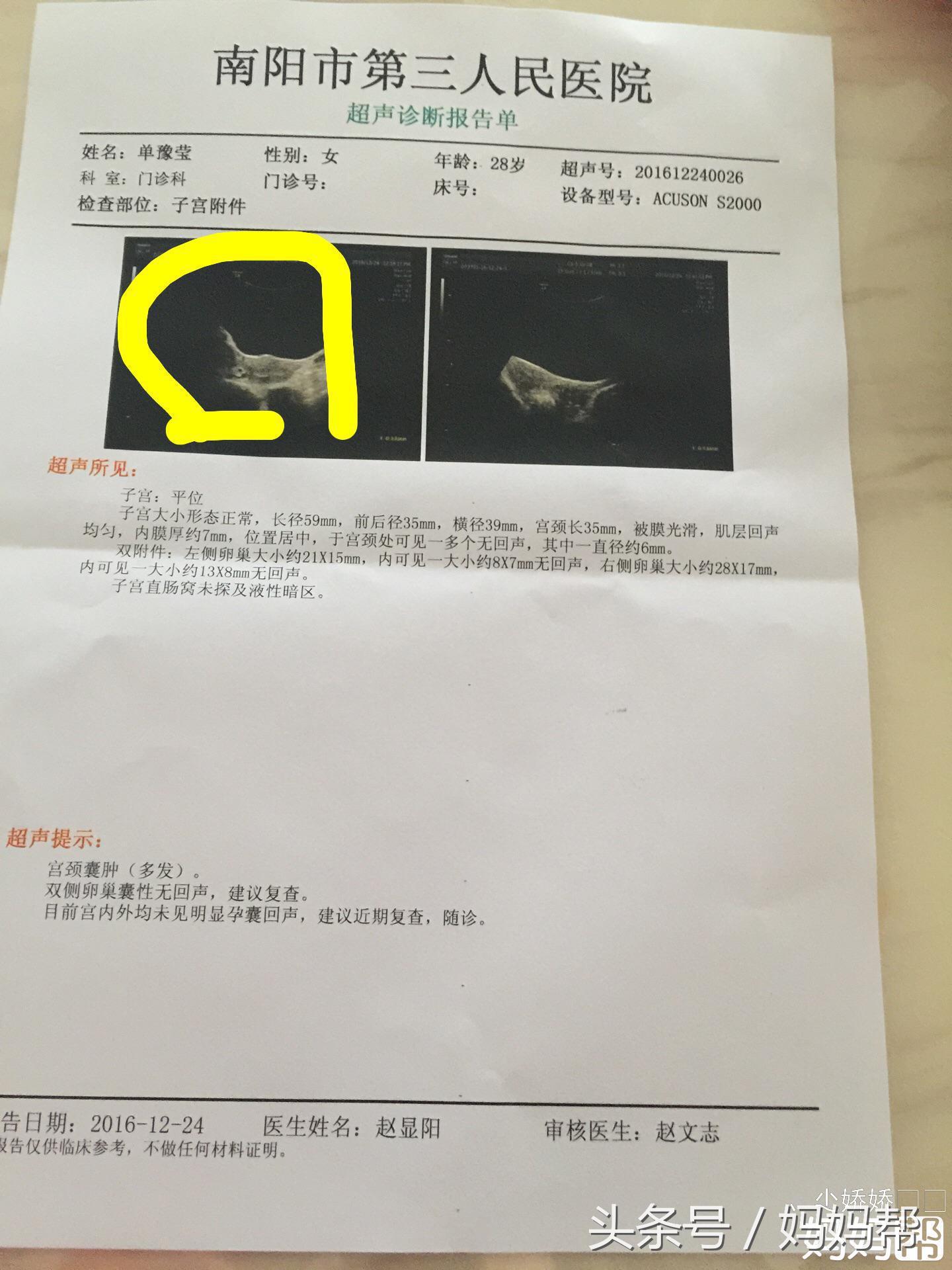 孕早期见红、hcg低别担心，你应该做这几件事！