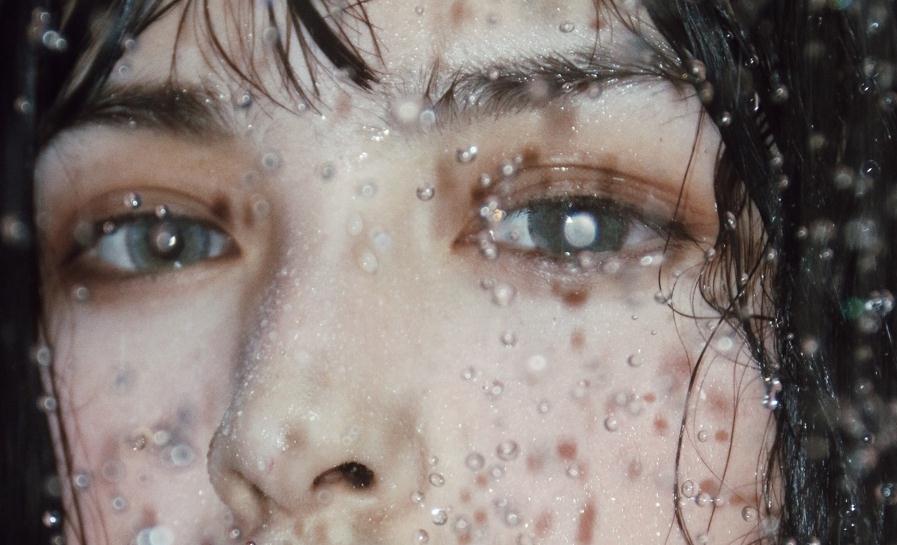 消除黑眼圈和眼袋的最有效的方法,最严重的黑眼圈