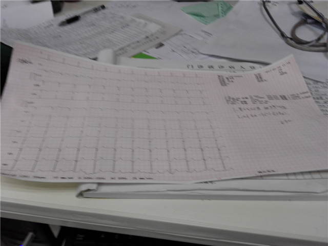 经方加减治疗心悸,张仲景治心律不齐的方剂