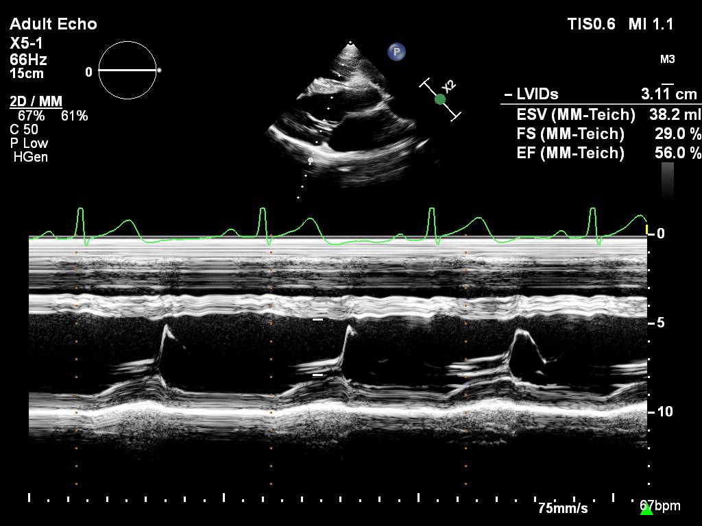 那些年我们错过的人,那些年我们错过的好歌