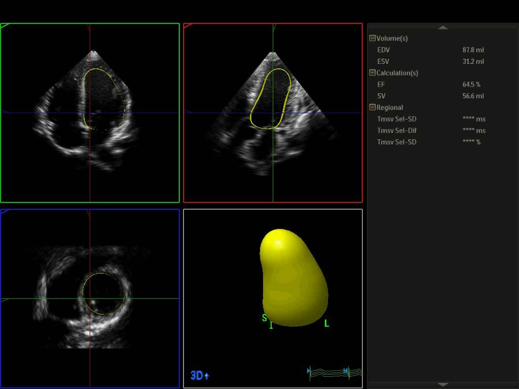 那些年我们错过的人,那些年我们错过的好歌