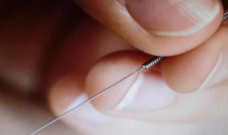 倪海厦针灸治疗脂肪肝,针灸可以治疗脂肪肝吗