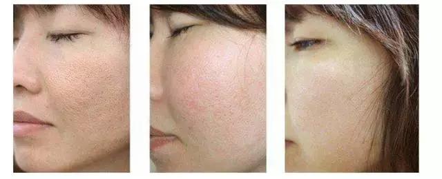 无美颜无滤镜遮毛孔,高级美颜相机祛皱美白