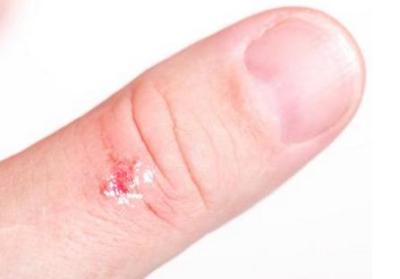 女性熬夜引发的病症,女性熬夜造成疾病