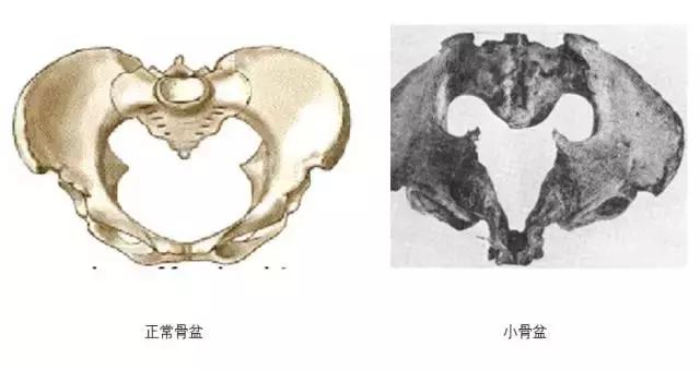 叶酸和维生素d缺乏影响怀孕吗,怀孕只吃了叶酸跟钙片其它都没吃