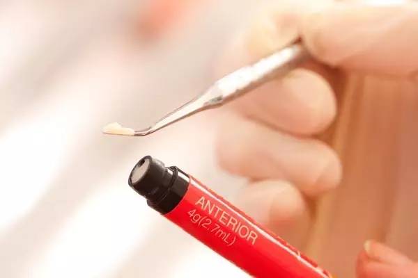 蛀牙不补怎么小洞变大了,蛀牙小洞不补大洞受罪