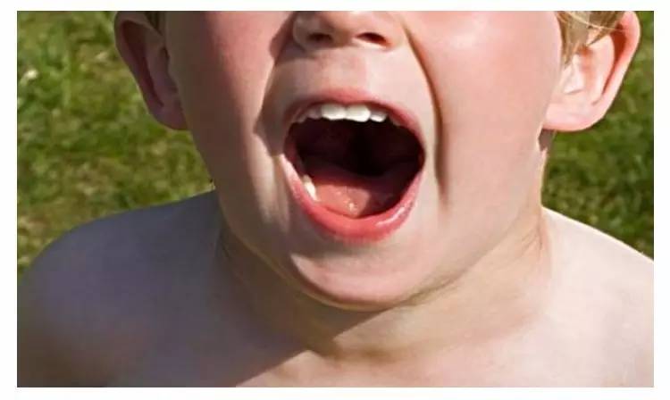 嗓子哑咳嗽有痰怎么调理,孩子嗓子哑了怎么调理