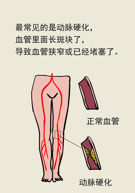 走着走着腿站不起来了是怎么回事,为什么走着走着腿就不累了