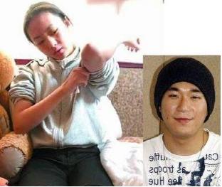 童瑶被张默打的图片,童瑶被张默打怎么处理的