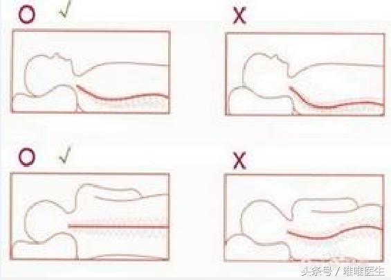 颈椎病腰椎病正确睡姿图片,软组织型颈椎病的正确睡姿
