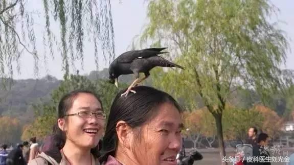 头皮屑多是不是缺少维生素b2,头皮屑多是不是皮肤病