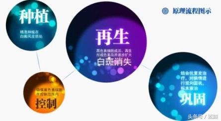 白癜风面积比较大怎么办