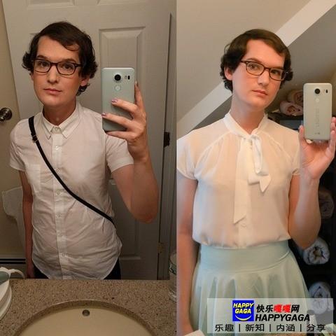 雌激素治脱发,雄性激素脱发补充雌性激素有用吗