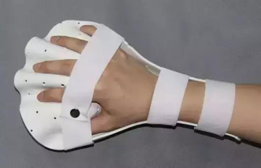 多关节挛缩治疗方法,手指关节挛缩的症状