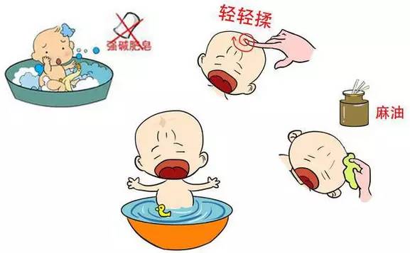 新生儿需要注意的事项和保养,新生儿照顾重点