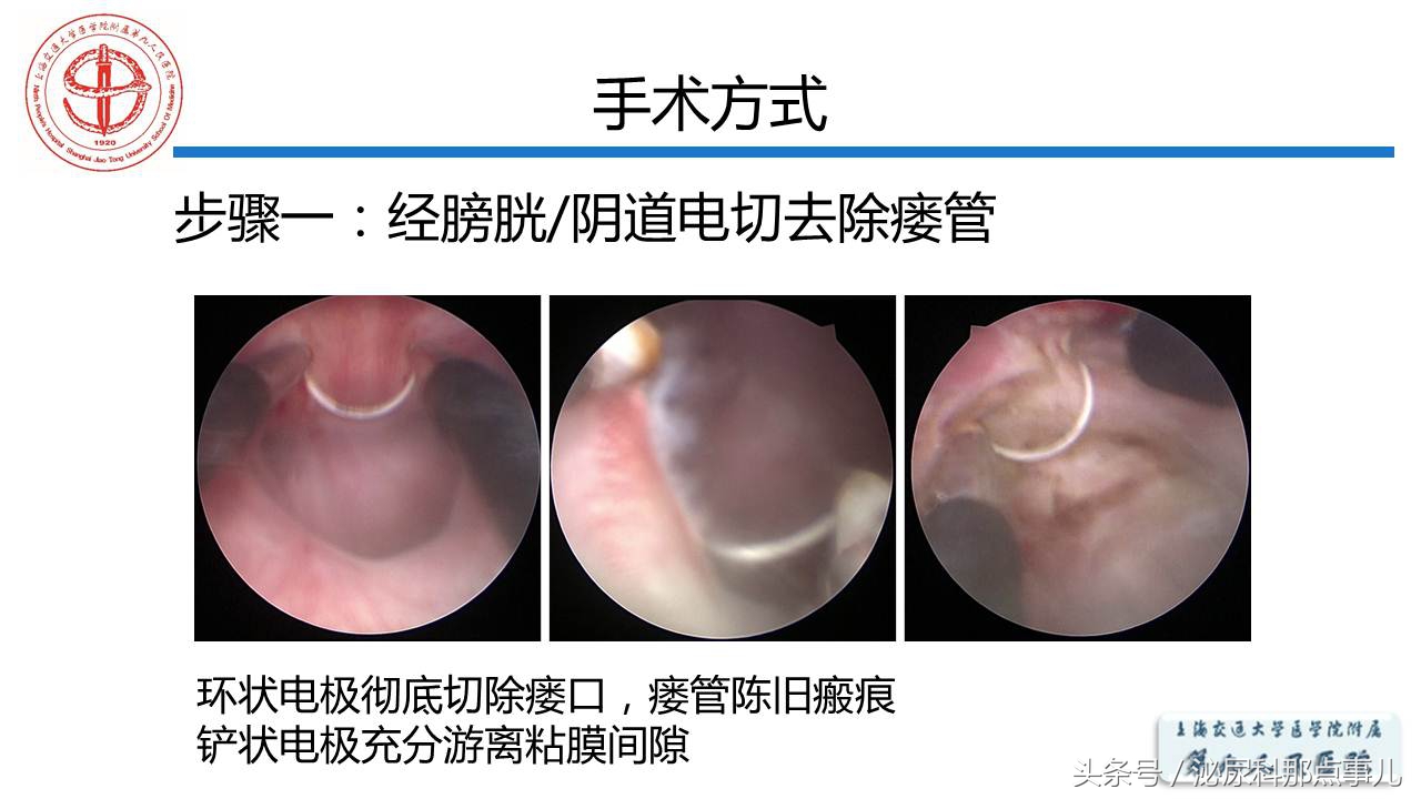 泌尿男科王忠教授,泌尿外科专家王忠教授