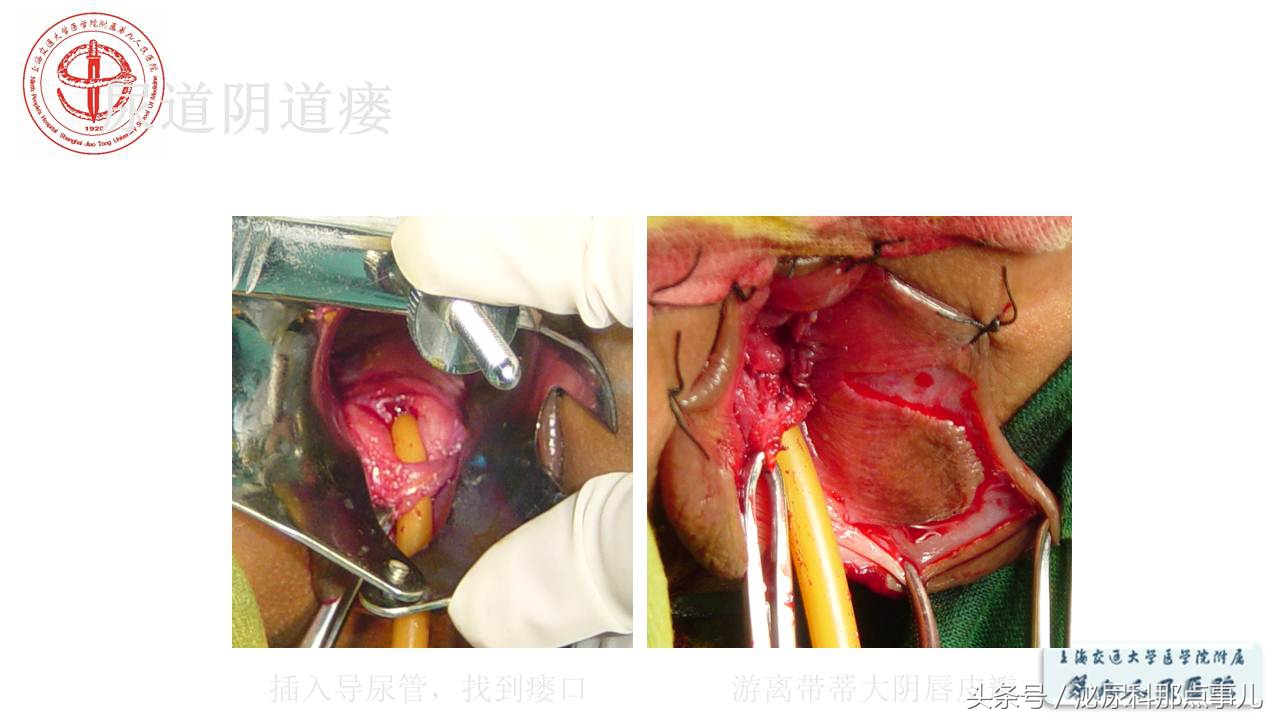 泌尿男科王忠教授,泌尿外科专家王忠教授